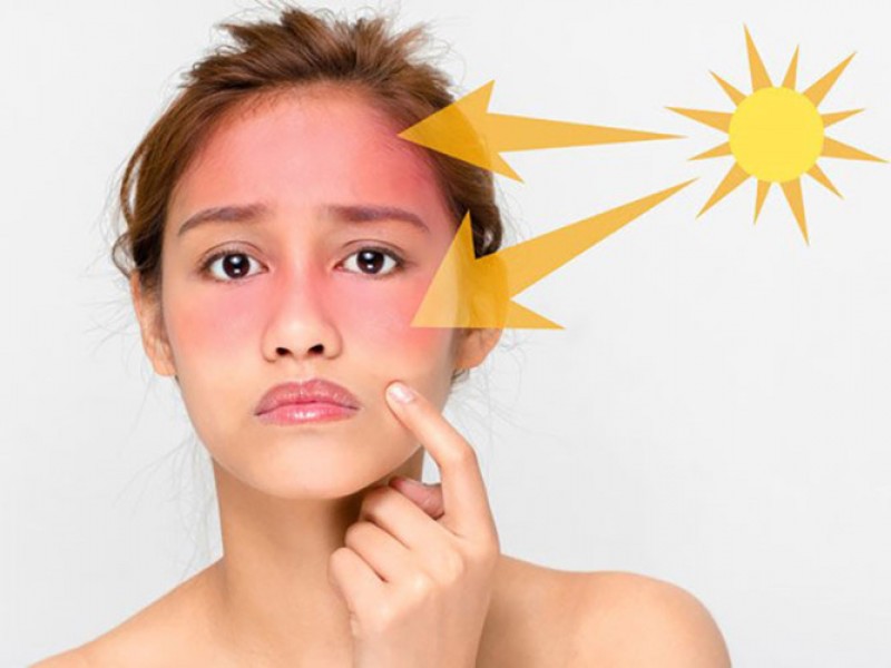 Phục hồi nhả nắng cấp tốc Treatment-3X Facial